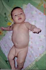 Андрей в начале лечения