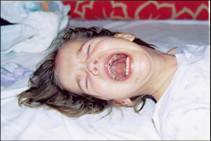 Хема до лечения