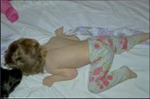 Хема до лечения